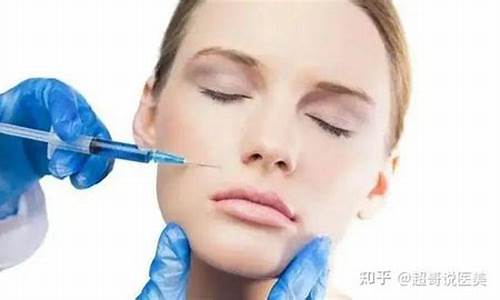法令纹填充需要几支玻尿酸